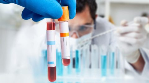 Centro Smile Punto prelievi per esami di laboratorio