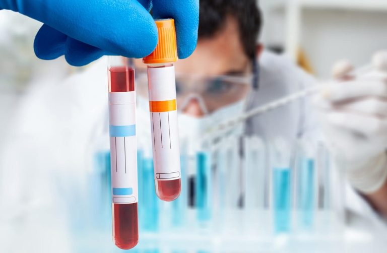 Centro Smile Punto prelievi per esami di laboratorio