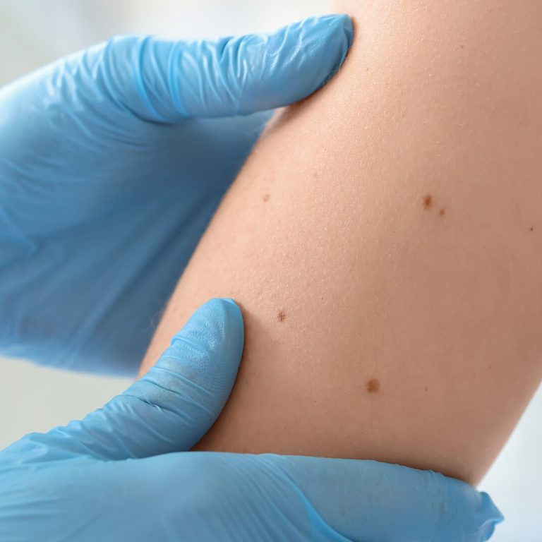 Centro Smile Dermatologia
